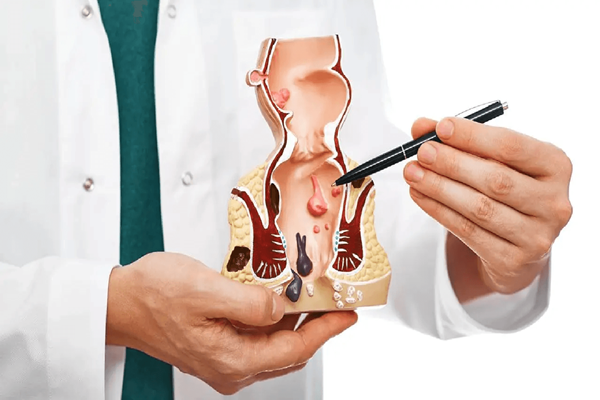 Picture of Anal Disorder Care ( Piles, Fissure, Fistula )
